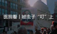 医我看丨被虫子“叮”上 
，发现“高烧和焦痂”？别大意，这样急救	
！