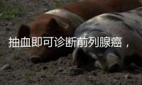 抽血即可诊断前列腺癌，拜登为何不测	？