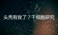 头秃有救了	？干细胞研究阐明压力如何影响毛发生长