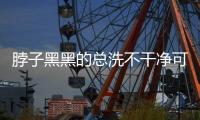 脖子黑黑的总洗不干净可能是病了
，这些疾病信号赶紧自查