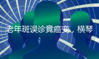 老年斑误诊竟癌变，横琴医院提醒：医学美容需科学诊断与规范治疗